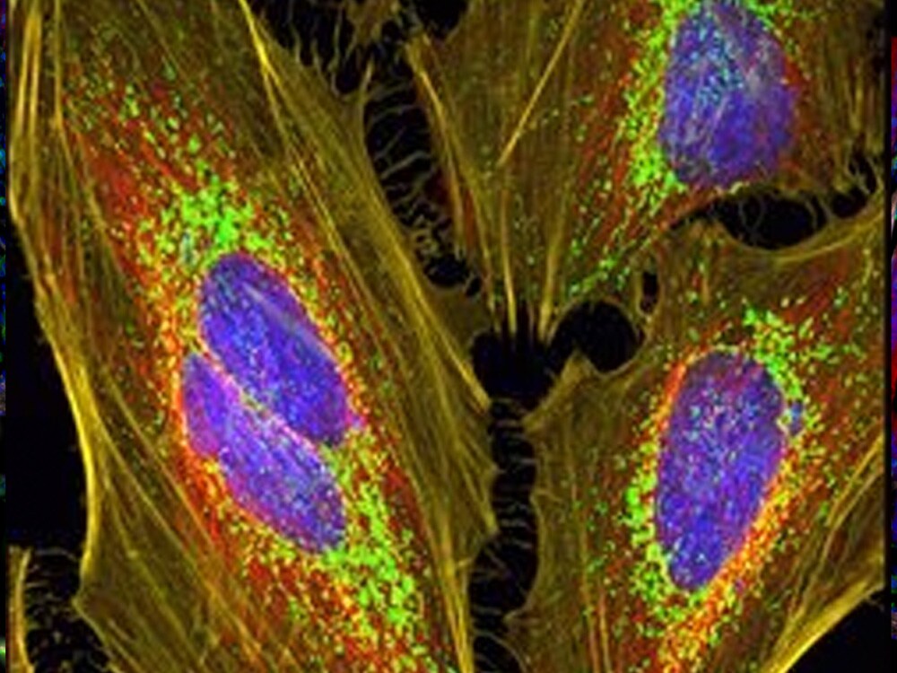 prolong glass antifade fluorescent cells mounted with prolong glass antifade