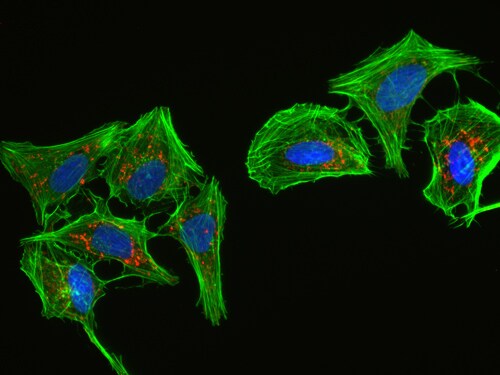prolong rapidset antifade fluorescent cells mounted with prolong rapidset antifade