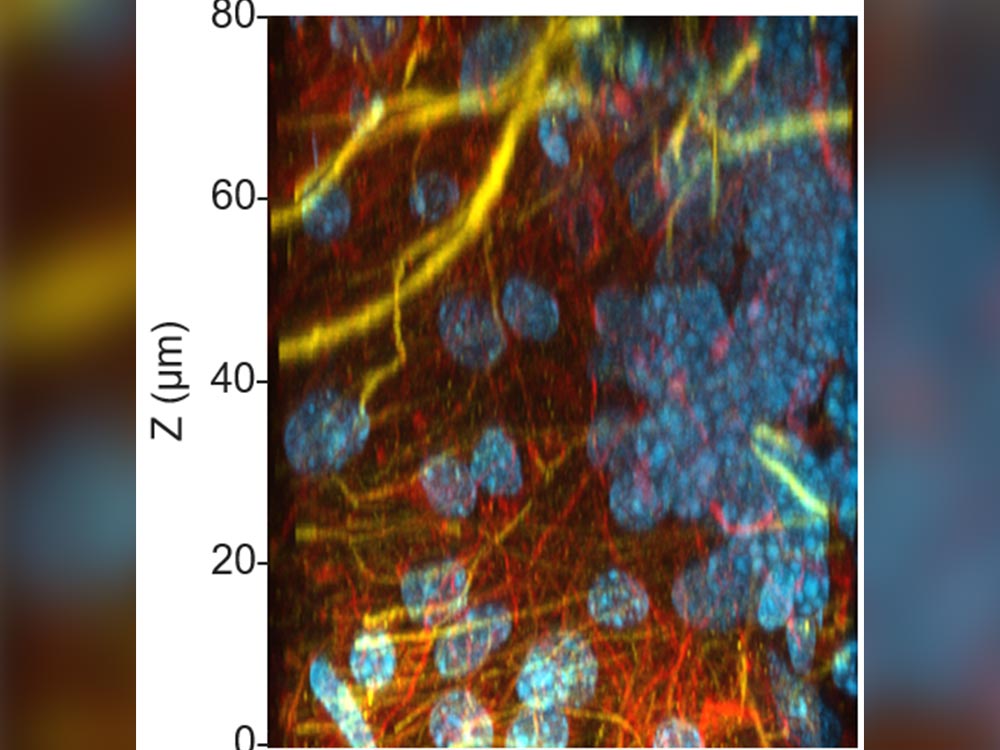 prolong rapidset antifade 100 µm thick cryo-preserved rat brain sections fluorescently labeled and mounted with prolong rapidset antifade