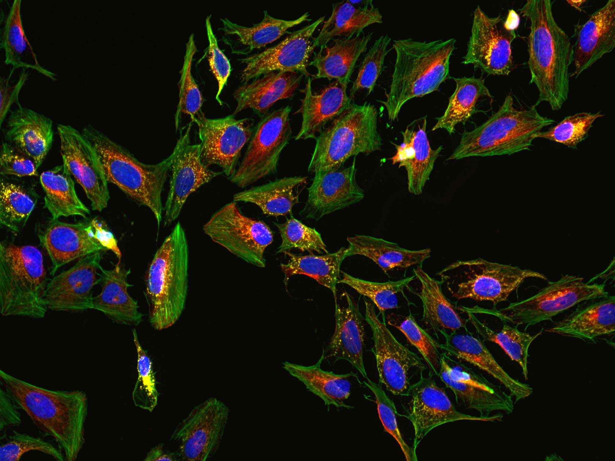 prolong rapidset antifade fluorescent cells mounted with prolong rapidset antifade