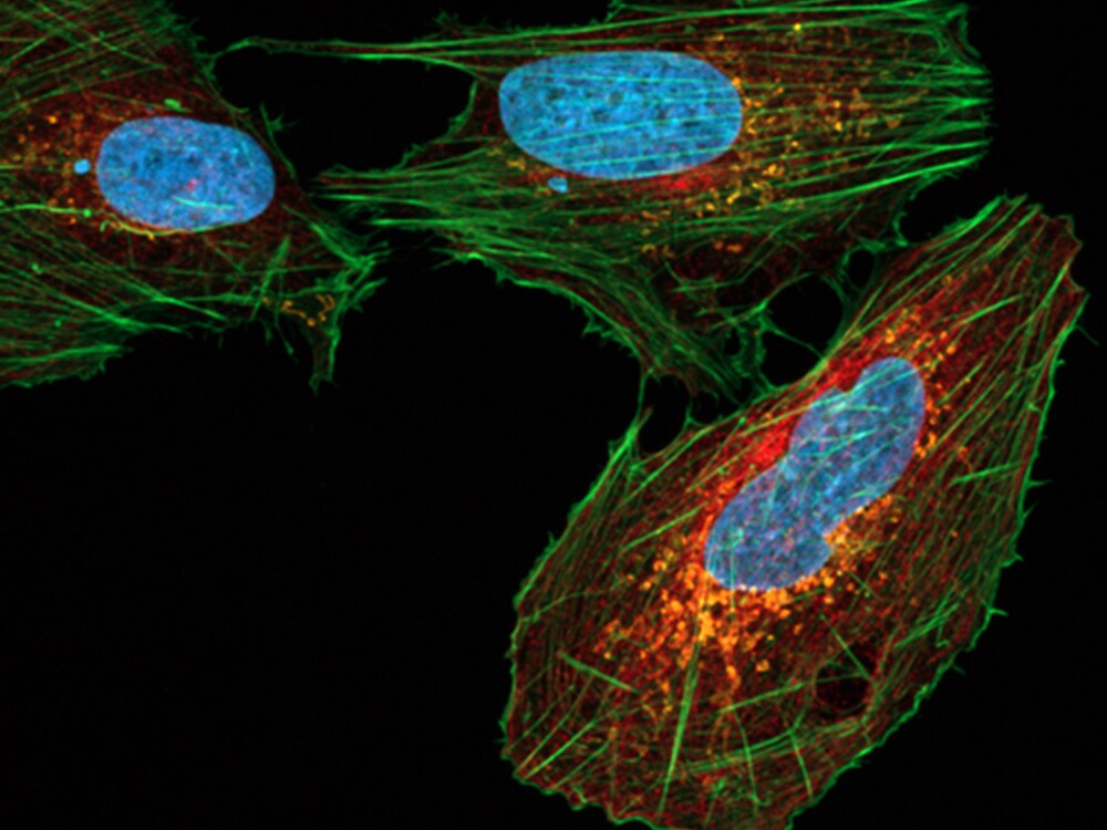 prolong rapidset antifade fluorescent cells mounted with prolong rapidset antifade