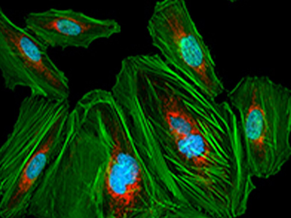 prolong rapidset antifade FFPE mouse brain fluorescently labeled and mounted with prolong rapidset antifade