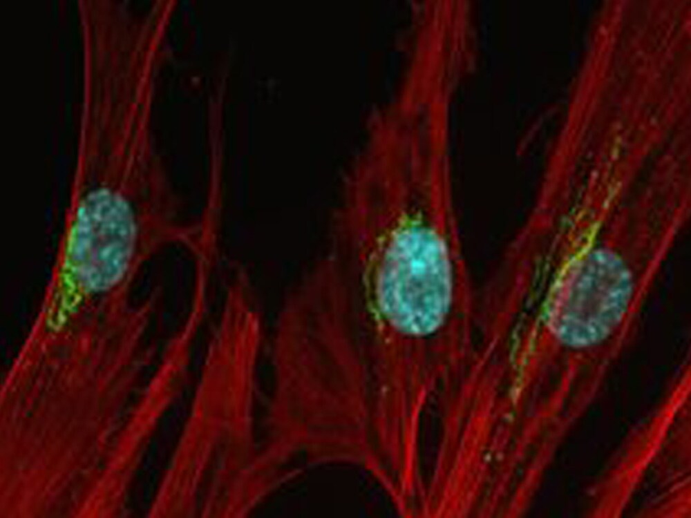 neonatal-human-dermal-fibroblasts-image neonatal-human-dermal-fibroblasts-image