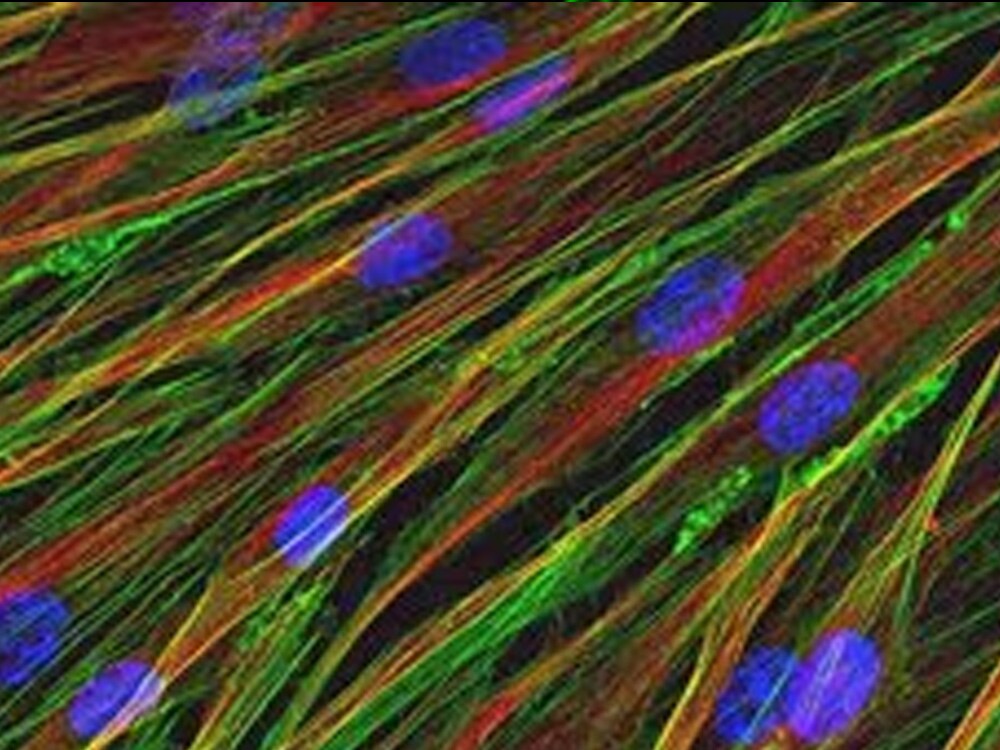 neonatal-human-dermal-fibroblasts neonatal-human-dermal-fibroblasts