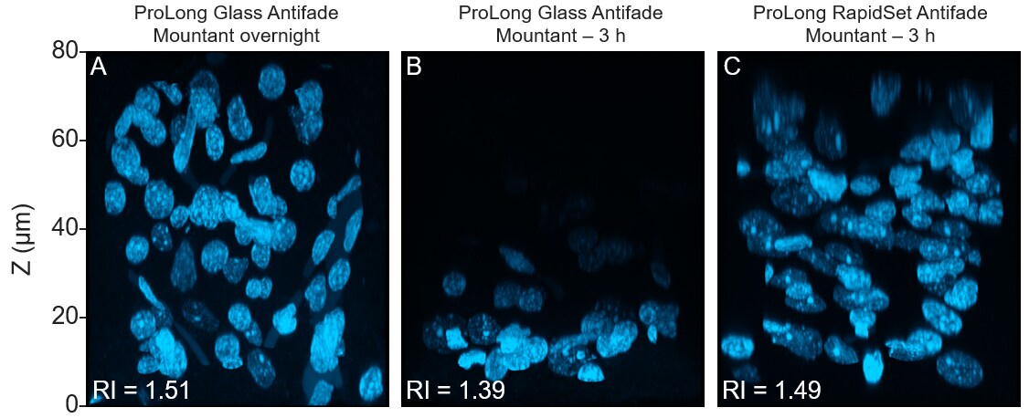 ProLong RapidSet fast-curing mountant vs ProLong Glass microscope images of stained rat brain sections in 3 mountants