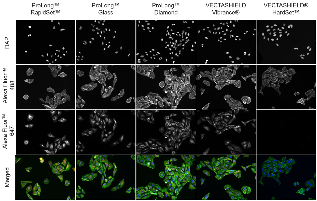 performance of fluorescent dyes and proteins prolong antifade mountants performed better than competitors to protect fluorescent intensity of various dyes and proteins