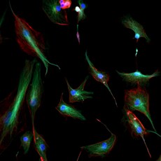 BPAE cells imaged using the CellInsight CX5 platform BPAE cells imaged using the CellInsight CX5 platform