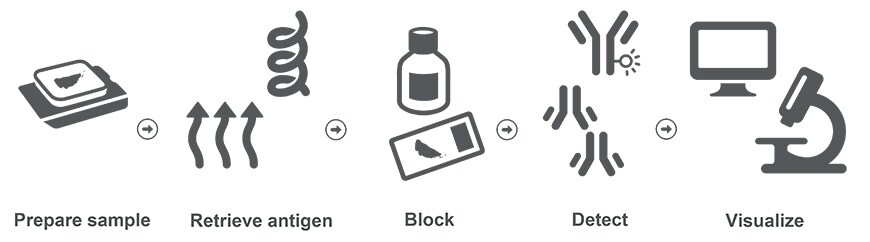 Five steps for immunohistochemistry Illustration showing five steps for immunohistochemistry, icons representing sample preparation, antigen retrieval, blocking, detecting, and visualization