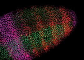 In Situ Hybridization (ISH) In Situ Hybridization (ISH)