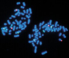 Fluorescence in situ hybridization (FISH) Fluorescence in situ hybridization (FISH)