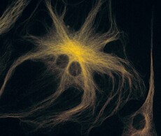 fluorescent image of cells cells labeled with anti-tubulin shown with yellow fluorescence
