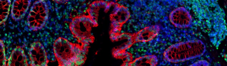 Alexa Fluor Fluorescent Streptavidin and Avidin Conjugates Decorative image