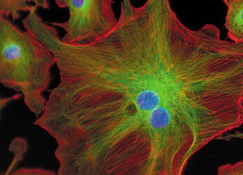 stained bovine pulmonary artery endothelial cells Microscopic view of BPAEC stained with alpha-tubulin (green), F-actin (red), and nuclei (blue)