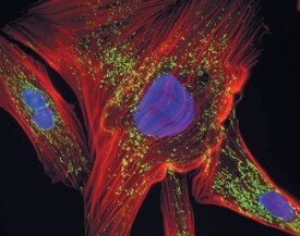 Muntjac skin fibroblasts showing mitochondrial damage Microscopic image of muntjac skin fibroblasts showing red actin, green mitochondria and blue nuclei.