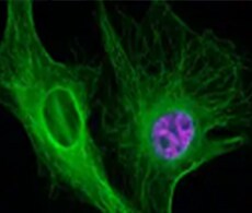 Optical Bottom 96-well plate Close up of neurons in green and purple