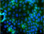 Nunclon Delta Cell Culture treated plastics for adherent cells A macro of a Nunclon Delta treated surface