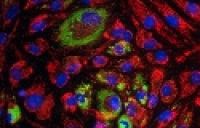 3-color fluorescence imaging of Human MSCs cultured with GlutaMAX media Microscopic view of fluorescently stained MSCs in adipogenic differentiating conditions