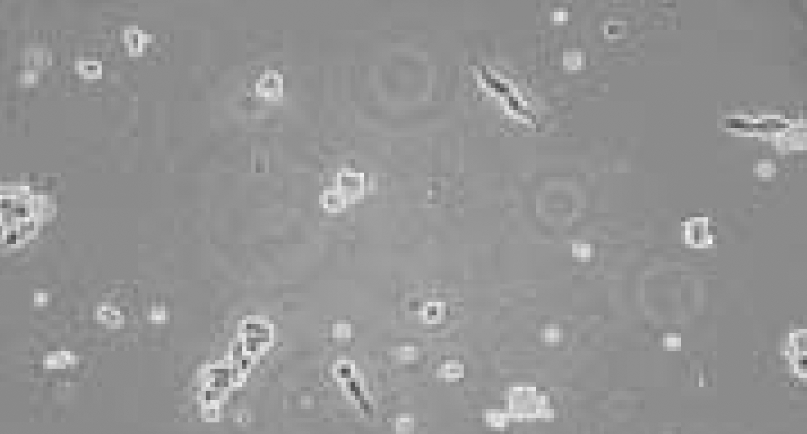 Cells treated with Trypsin Brightfield image of cultured cells after trypsin treatment