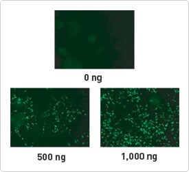 Lipofectamine LTX with PLUS Reagent transfection efficiency Three micrographs demonstrating how Lipofectamine LTX with PLUS Reagent efficiently transfects primary neural cells; the 1,000 ng image shows the most GFP activity