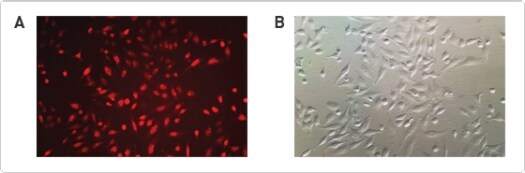 Results from morphology study following transfection with RNAiMAX reagent Two microscopy images, one in fluorescence which HeLa cells are transfected with Invitrogen BLOCK-iT Alexa Fluor Red Fluorescent Control using RNAiMAX reagent and bright-field image 24 hr after transfection.