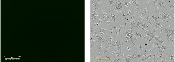 Time-lapse micrographs of human ES cells Time-lapse fluorescence and phase-contrast micrographs showing human ES cells successfully transfected using Lipofectamine Stem reagent. side by side