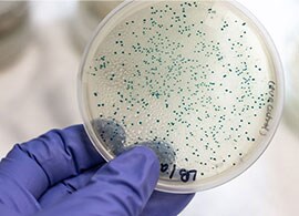 Model organism E. coli A scientist’s gloved hand holding a petri dish with hundreds of distinct E. coli colonies