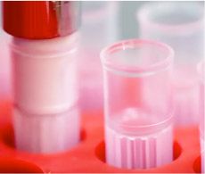 PCR Reagents and Enzymes PCR Reagents and Enzymes