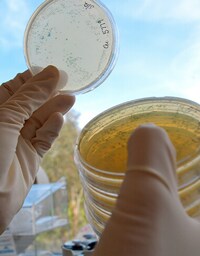 Competent Cells Scientist observing petri dish with white and blue colonies