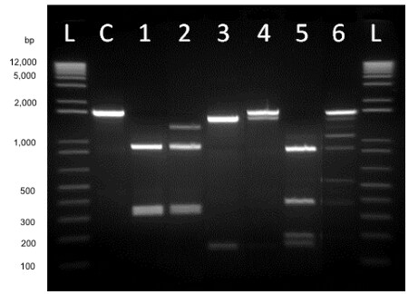 Anza restriction enzymes are formulated to complete digestion in just 15 minutes Anza restriction enzymes are formulated to complete digestion in just 15 minutes