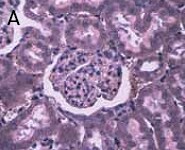 dat-fig1a Laser Capture Microdissection