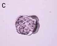 laser capture microdissection laser capture microdissection