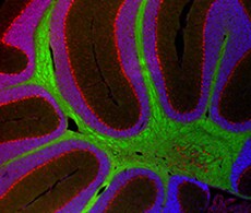 Neuroscience Research with Laser Capture Microdissection (LCM) Neuroscience Research with Laser Capture Microdissection (LCM)