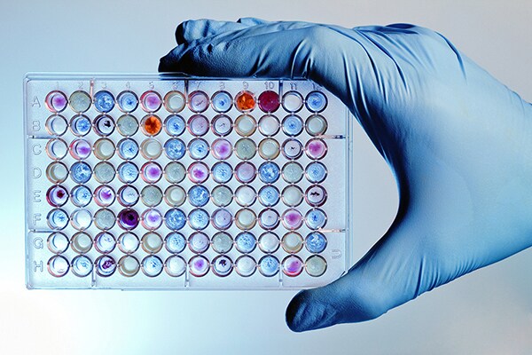 Using CRISPR controls in a CRISPR-Cas9 experiment Gloved hand holding a 96-well plate with colorful samples