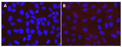 Monitoring Cas9 delivery with immunocytochemistry Fluorescent micrograph of control and Cas9-expressing U2OS cells