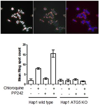 Automatic quantitation of autophagy using HCS Three microscopic images of cells expressing different colors of fluorescence and a bar chart showing the quantified readouts