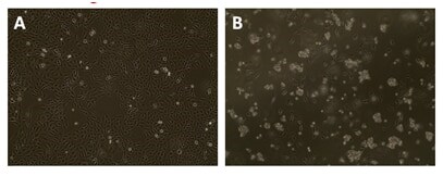 Cell imaging to observe antibiotic selection Transmitted light micrograph of transduced cells cultured in the absence or presence of puromycin