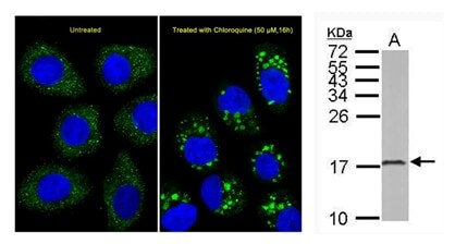 CRISPR-edited Hap1 cells accumulate LC3B after chloroquine treatment Cells emitting blue and green fluorescence to show the accumulation of LC3B after chloroquine treatment. Also shown is a western blot showing a band at 17 kDa corresponding to LC3B