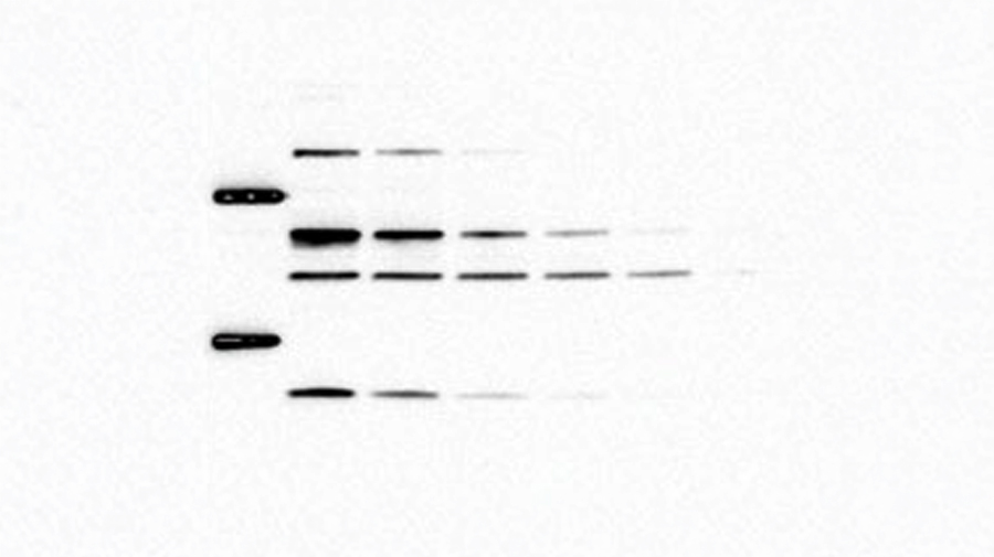 Chemiluminescent Western Blot Detection Chemiluminescent Western Blot Detection