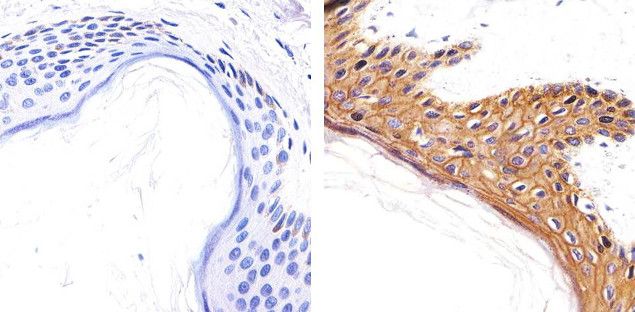 CD138 antibody in IHC (FFPE). CD138 antibody in IHC (FFPE).
