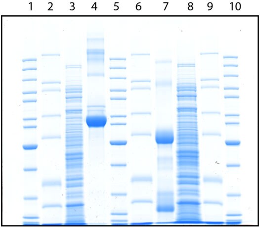 Proteins separated on a Novex tris-glycine gel, stained with Simple Blue safe stain Proteins separated on a Novex tris-glycine gel, stained with Simple Blue safe stain