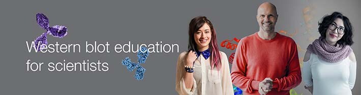 Protein Gel Electrophoresis and Western Blotting Education Center Protein Gel Electrophoresis and Western Blotting Education Center