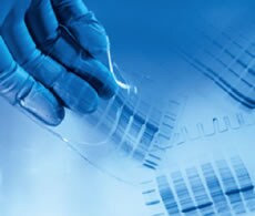 coomassie-dye-protein-gel-stains coomassie-dye-protein-gel-stains