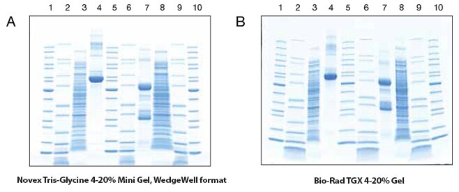 High band quality is observed with Novex Tris-glycine gel compared to other commercial suppliers High band quality is observed with Novex Tris-glycine gel compared to other commercial suppliers
