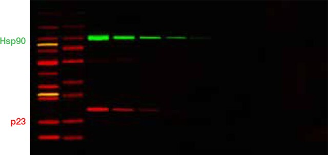 Novex Tris-glycine gels deliver sharp straight bands Novex Tris-glycine gels deliver sharp straight bands