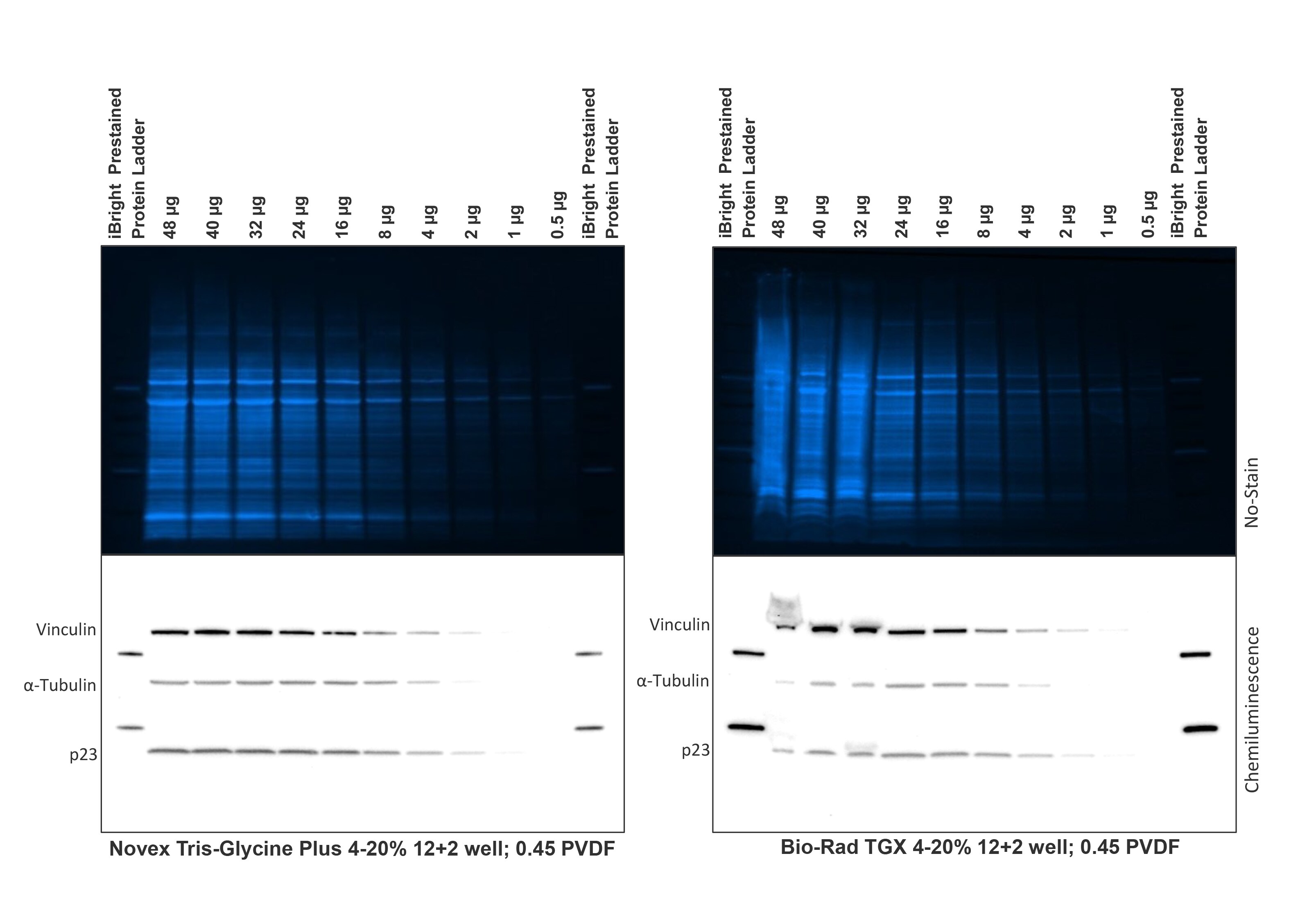 Cell lysate load comparison between western blots of Novex 4–20% Tris-Glycine Plus and Bio-Rad 4-20% TGX midi gels Western blots using Novex 4–20% Tris-Glycine Plus midi gels display sharper bands at greater protein and RIPA lysis buffer loads than Bio-Rad 4–20% TGX midi gels. The Bio-Rad blot shows streaking, bowing of bands above 24 µg protein, and bleed-over into the ladder lane for total protein analysis. With immunoblotting, the Bio-Rad blot shows band loss and smearing at higher loads for all targets.