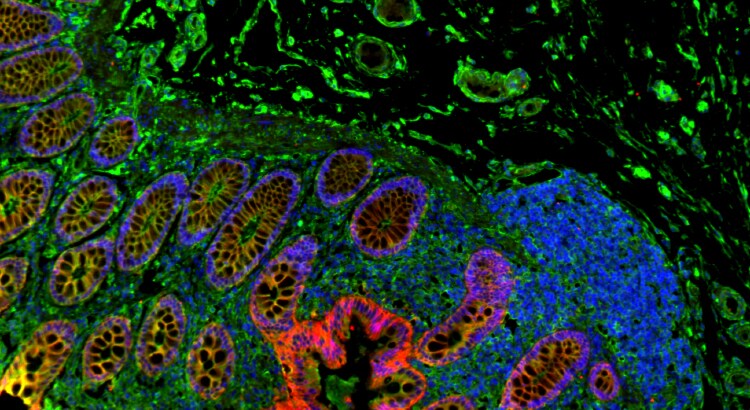 Stained tissue Tissue stained with various fluorescent dyes