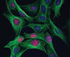 RNA synthesis EU incorporation shows red RNA, green tubulin, and blue nuclei