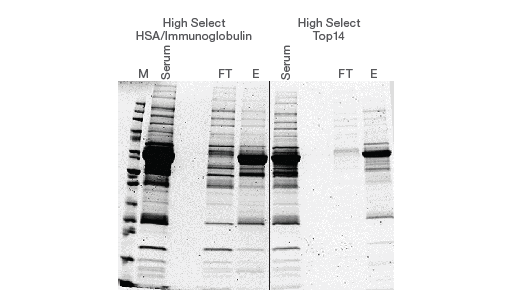 Abundant protein depletion improves identification of unique proteins Abundant protein depletion improves identification of unique proteins