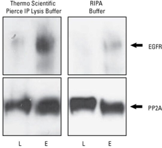 immunoprecipitation IP and RIPA buffer lysates