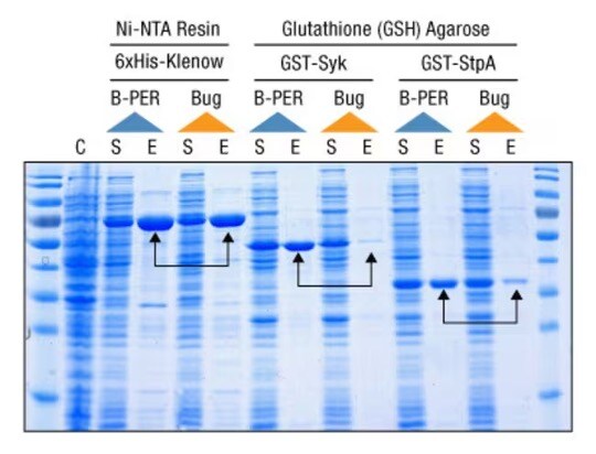 protein purification bacterial protein purification comparison using B-PER and competitor